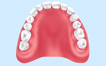 レジン床義歯（保険診療）